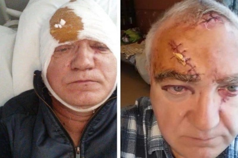 Мужчина получил битой по голове  из-за своей бдительности (2 фото)